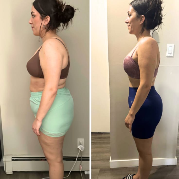 Referência visual de antes e depois, mulher de perfil